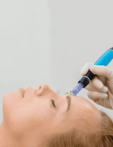 Hydrafacial en Beverly Hills