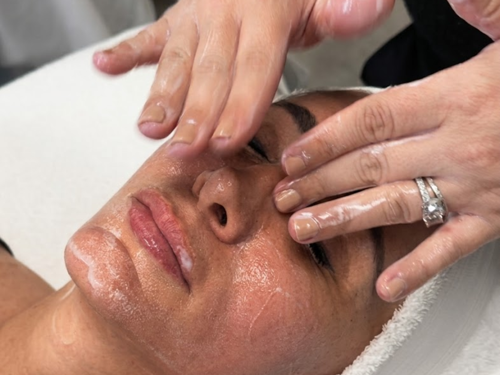 Why do clogged pores keep coming back?